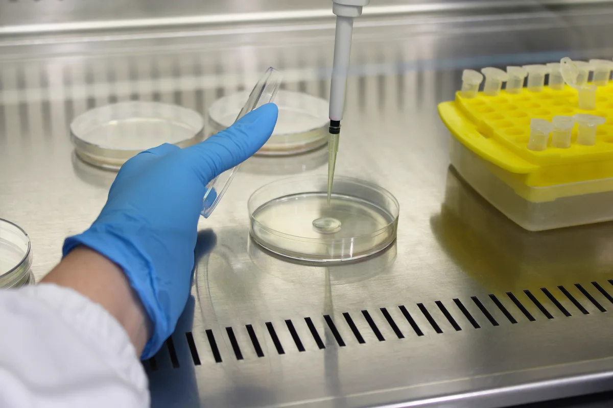 Semina su piastra durante lo screening microbiologico